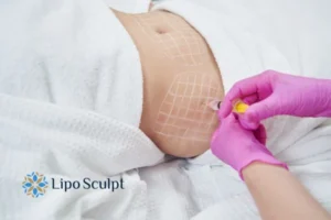 Are The Results From Aqualyx Permanent? 1 Do you want to know how long Aqualyx Brighton and Hove results last?