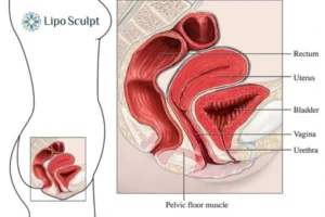 Treatment For A Leaky Bladder 2 How EM Chair treatment Brighton and Hove can help Leaky bladder issues. Read more now!