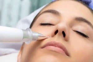 Best Actinic Keratoses Removal 3 Actinic keratoses Brighton and Hove solutions - book in today!